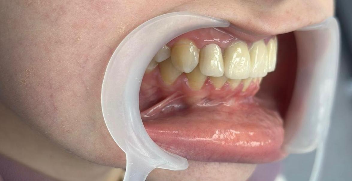 WhatsApp Image 2026-02-25 at 12.11.05 PM (3)